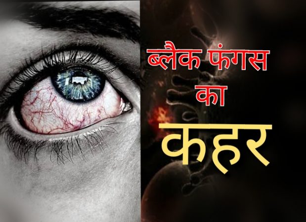 बिहार में ब्लैक फंगस के मामले में लगातार वृद्धि, 39 नए मरीज मिले, कुल मरीजों का आंकड़ा 174 पहुंचा
